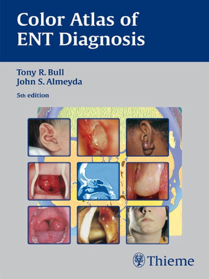 cover image of Color Atlas of ENT Diagnosis